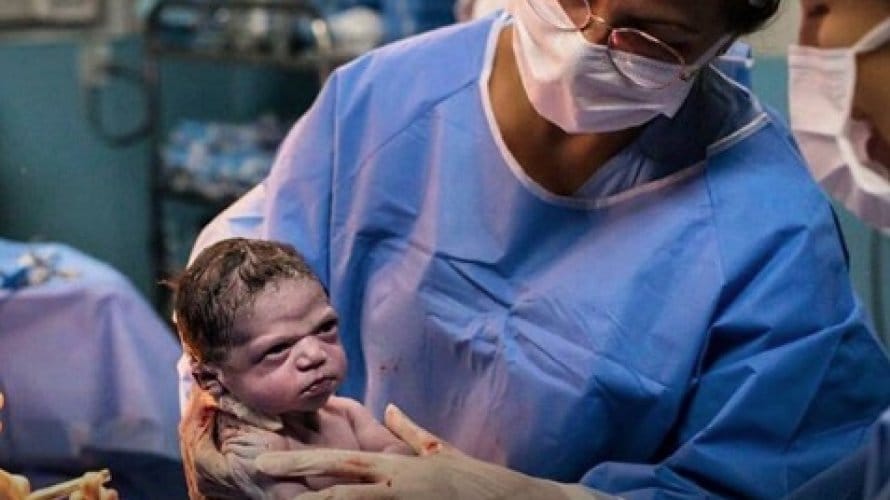 Bebê viraliza nas redes sociais ao nascer com cara “emburrada”
