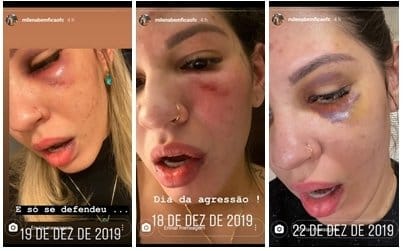 Ex-mulher do goleiro Jean posta novas fotos da agressão e diz que filhas pediram para pai parar 1 Ex mulher do goleiro Jean posta novas fotos da agressão e diz que filhas pediram para pai parar