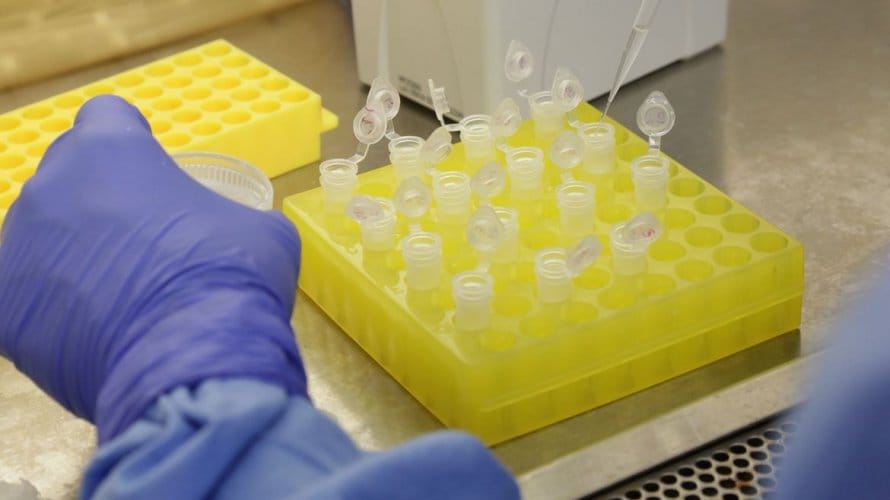 Coronavírus Bahia já tem 63 casos confirmados de Covid 19