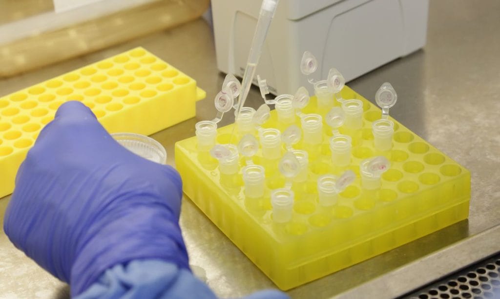 Coreia do Sul pessoas recuperadas testam positivo em segundo exame