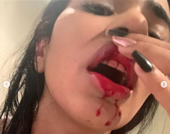Mulher de jogador do Boca Juniors denuncia violência doméstica durante quarentena