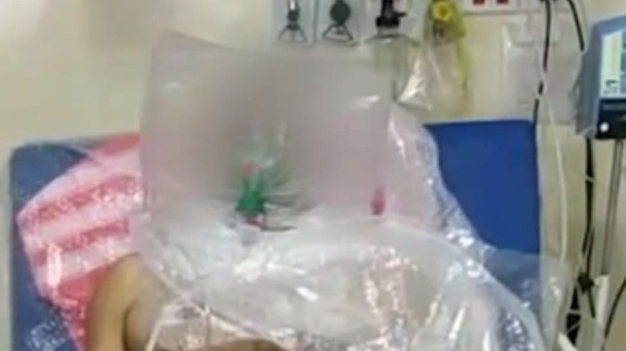 Médicos utilizam saco plástico para ajudar paciente a respirar em Manaus