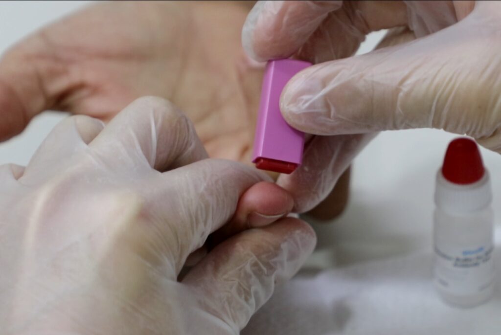 Covid 19 Brasil distribui metade dos testes que prometeu número de testados é desconhecido