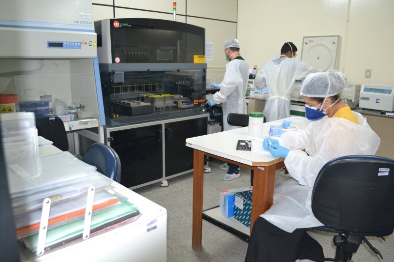 Lacen Sergipe libera mais de 2 mil resultados de exames da covid 19 feitos na Fiocruz