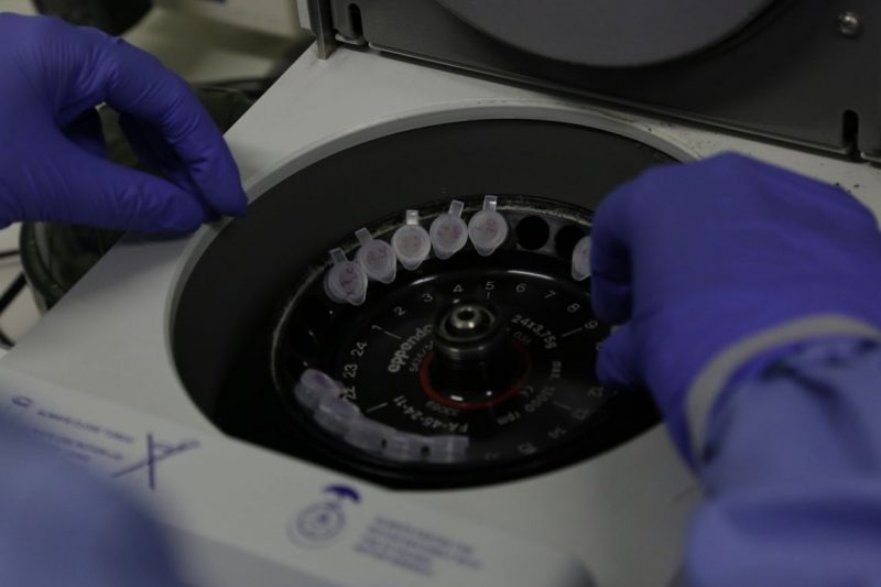 Casos globais de covid 19 superam 1134 milhões