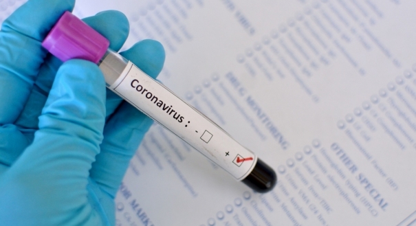 Covid 19 Ministério da Saúde entrega kit incompleto e Brasil só atinge 20 da capacidade de testes