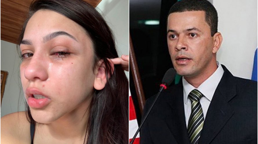 Filha de presidente da Câmara de Campo Formoso é agredida pelo pai Um monstro