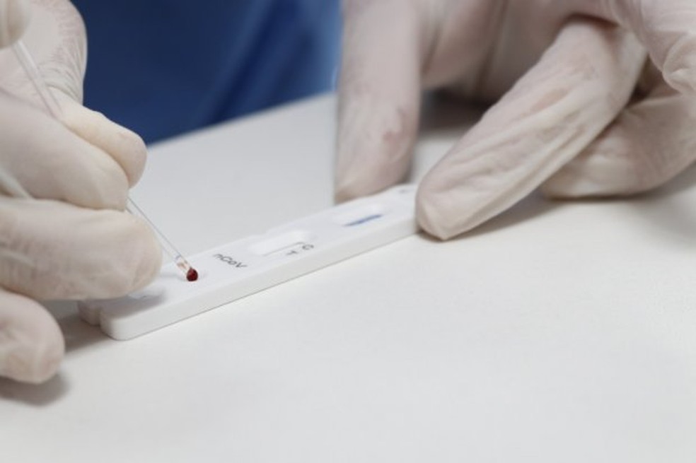 Brasil registra mais 23.101 casos confirmados do novo coronavirus