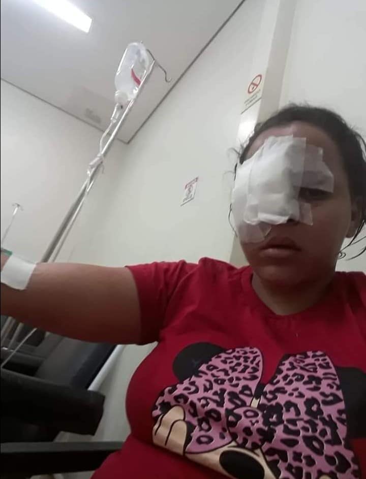 Cinegrafista da Record é suspeito de deformar rosto da ex companheira no Pará2