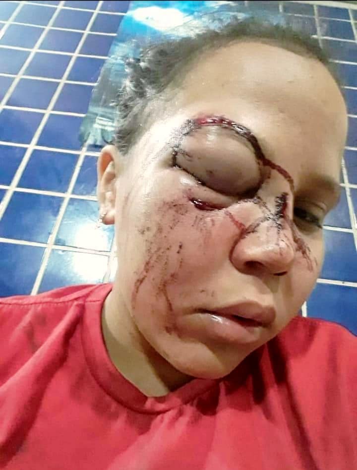 Cinegrafista da Record é suspeito de deformar rosto da ex companheira no Pará3
