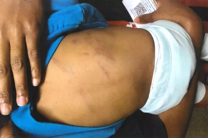 Homem e preso em flagrante apos chicotear bebe de noves meses