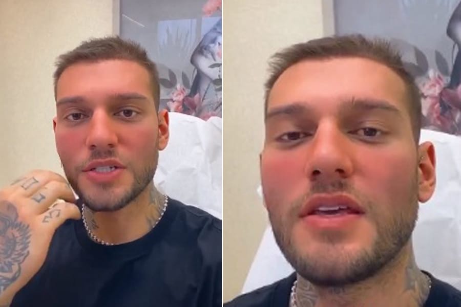 Lucas Lucco anuncia reversão de harmonização facial: “Ultrapassou o limite do que eu imaginava”