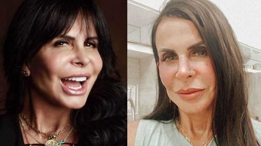 Gretchen faz nova harmonizacao facial e mostra resultado aos fas