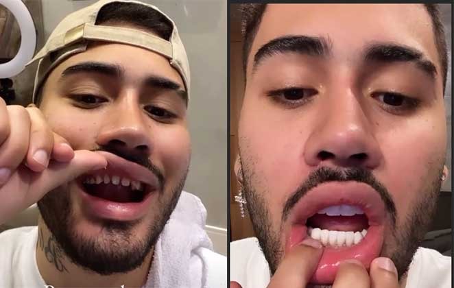 Kevinho-é-alvo-de-brincadeira-nas-redes-sociais-após-retirar-lentes-de-contato