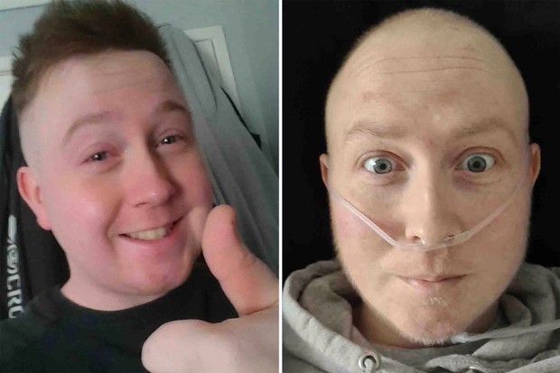 Youtuber David MacMillan morre de cancer raro apos dores no ombro
