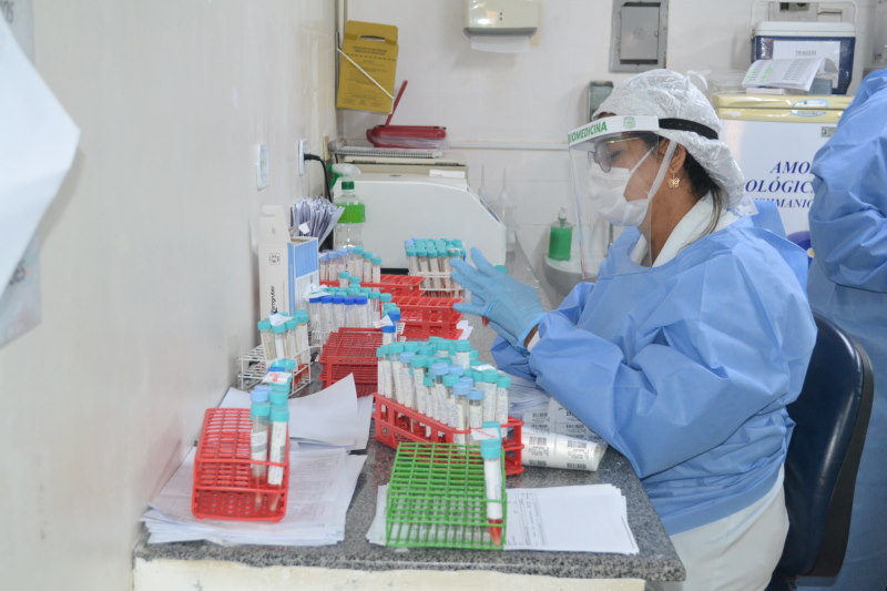Apos acumulo Lacen reduz demanda reprimida no processamento de amostras da covid 19 em Sergipe