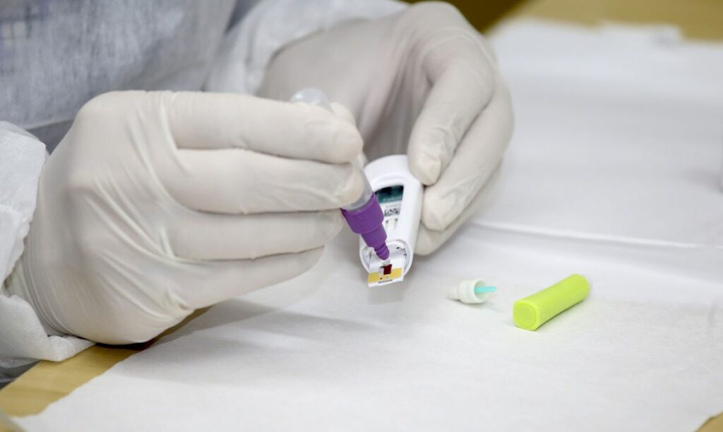 Covid 19 Brasil passa das 180 mil mortes desde inicio da pandemia