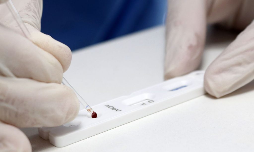 Covid 19 Brasil registra 51 mil casos e 842 mortes em 24 horas