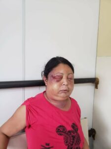 Mulher morre apos ser espancada a socos pelo companheiroo