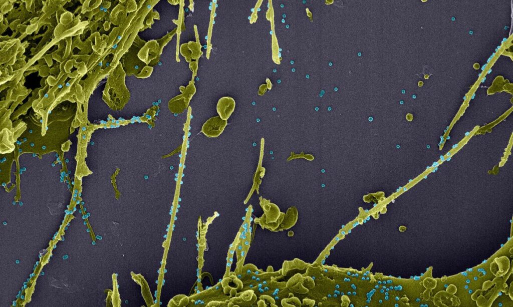 Pesquisadores identificam no Rio possivel nova linhagem do coronavirus