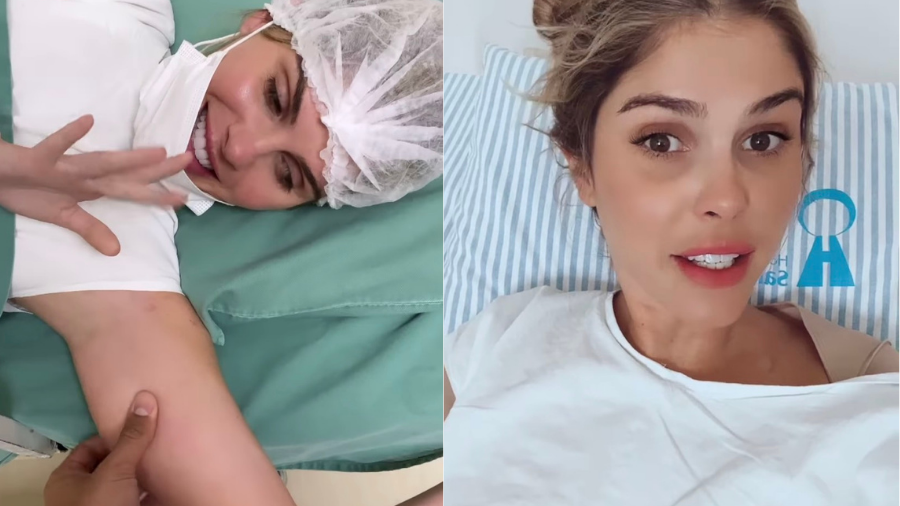 Bárbara-Evans-publica-foto-comemorando-cirurgia-para-retirada-de-gordura-do-braço