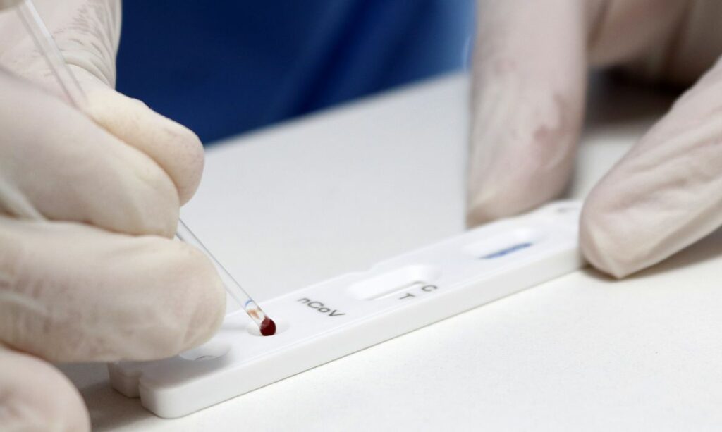 Covid 19 Brasil registra 584 mil casos e 12 mil mortes em 24 horas