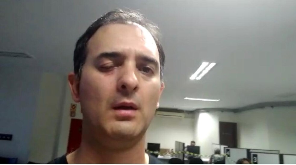 Homem e agredido com soco no olho por nao usar mascara dentro de UBSF
