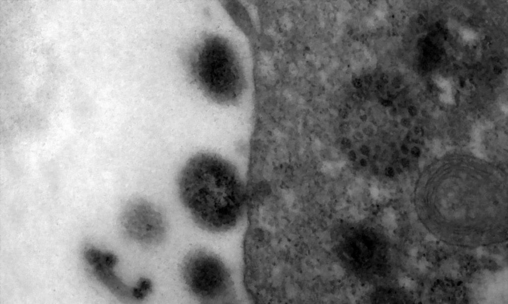 Covid 19 anticorpos podem durar ate 12 meses apos infeccao