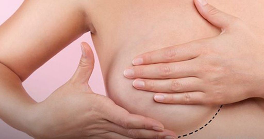 Femama alerta sobre mamografias apos vacina contra covid 19