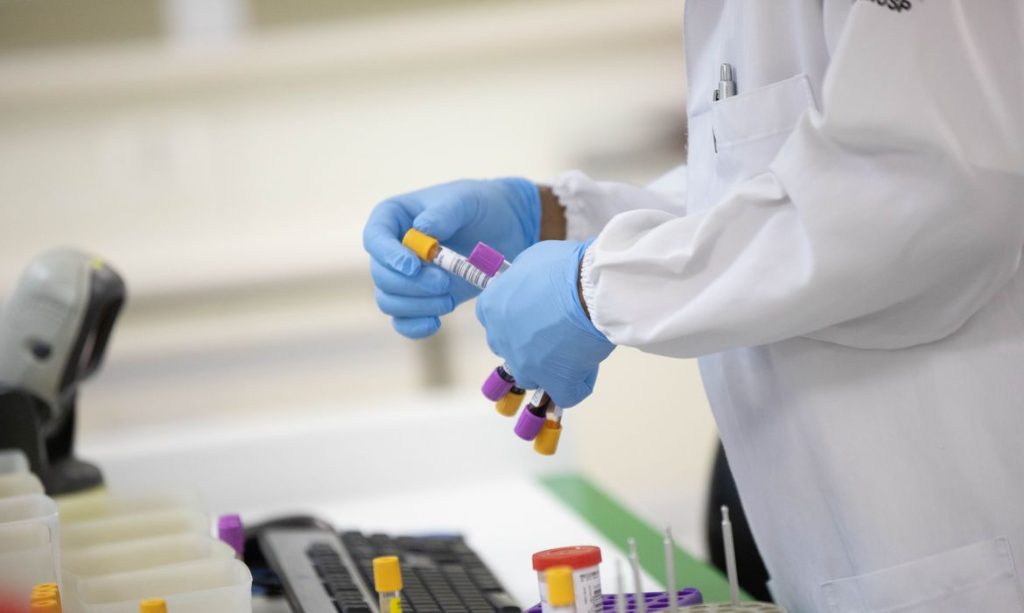 Brasil registra primeiro caso de reinfeccao com mesma mutacao do coronavirus encontrada na Africa do Sul