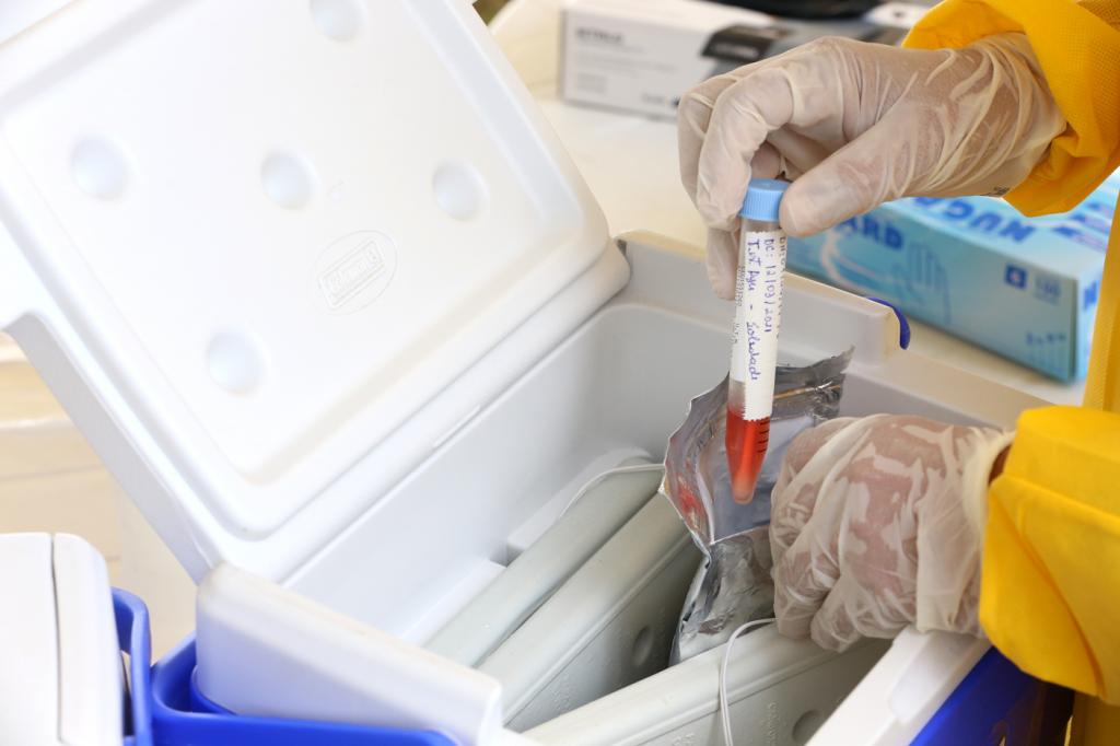Aracaju registra primeiro caso de dupla infeccao de covid 19 e influenza
