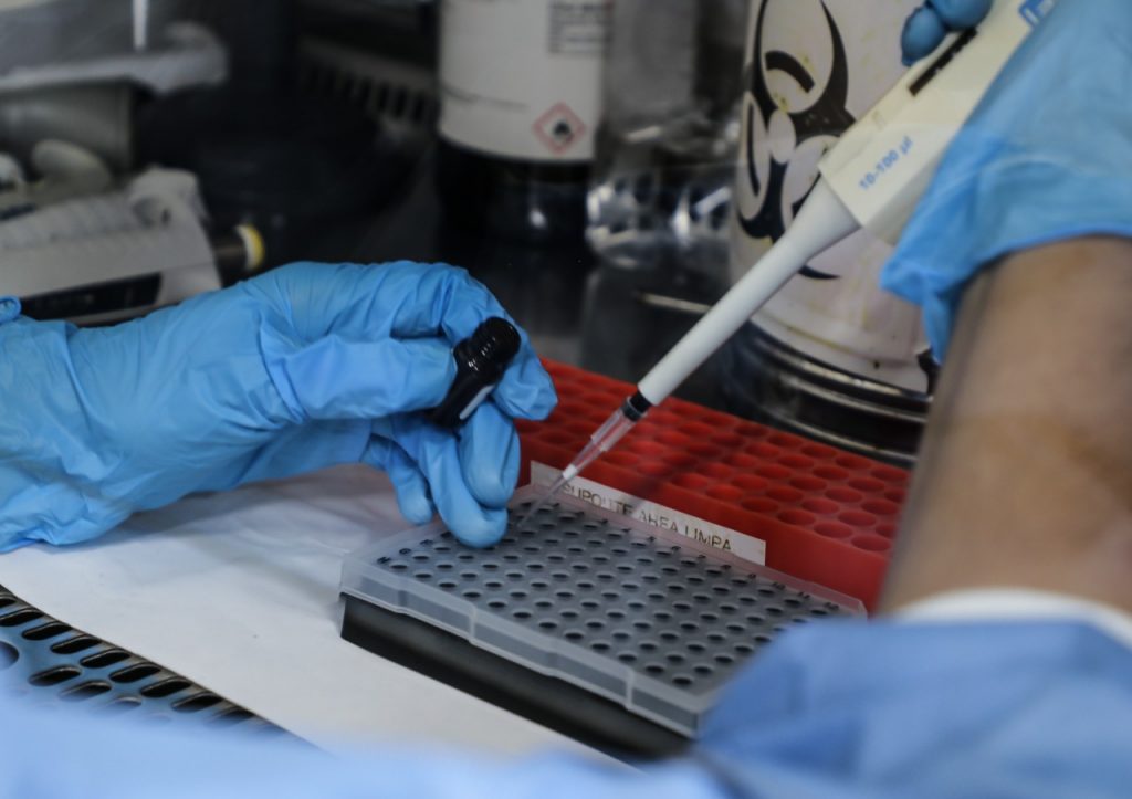 Sergipe confirma 53 casos de dupla infeccao por covid 19 e Influenza