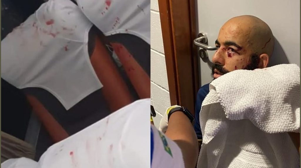 Jogadores do Bahia ficam feridos apos onibus ser atingido por bomba na Arena Fonte Nova