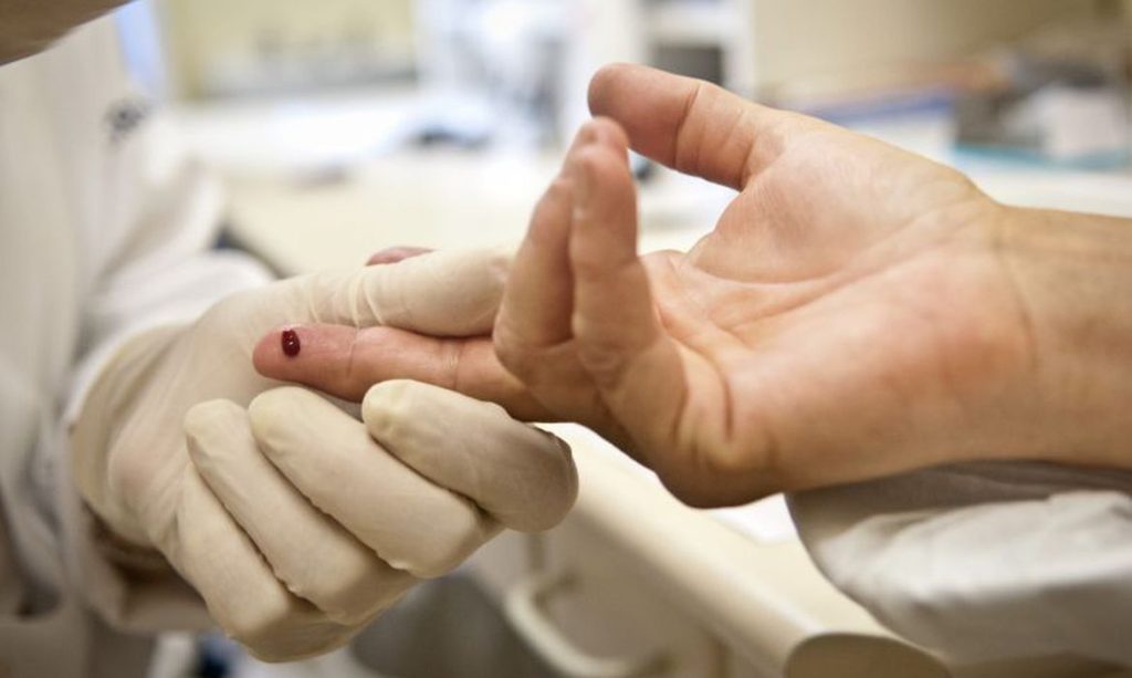 Paciente e declarado curado do HIV apos receber celulas tronco