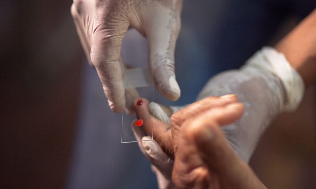 Aracaju confirma segundo caso de malaria em menos de uma semana afirma SMS