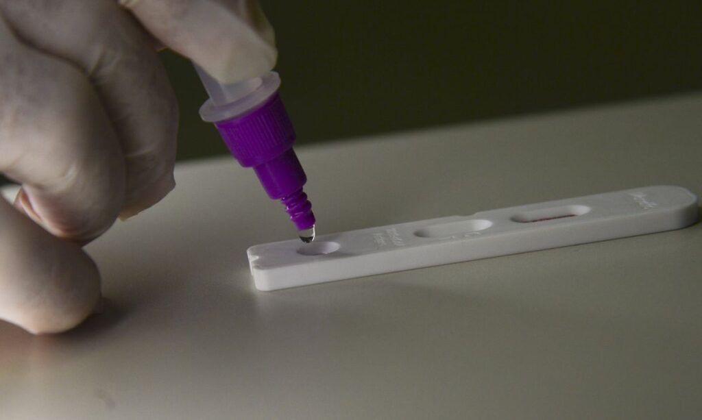 Brasil registra 38 mortes e 53 mil novos casos de covid 19