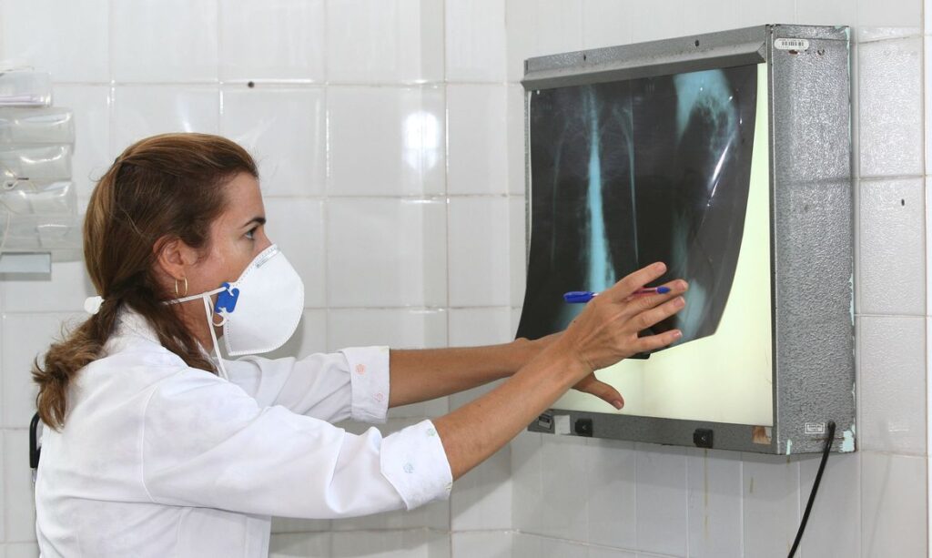Cresce numero de casos e mortes por tuberculose no mundo 16 milhao de pessoas morreu em 2021Cresce numero de casos e mortes por tuberculose no mundo 16 milhao de pessoas morreu em 2021