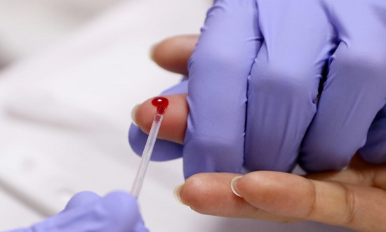 Saude aponta crescimento de casos de Sifilis em Sergipe