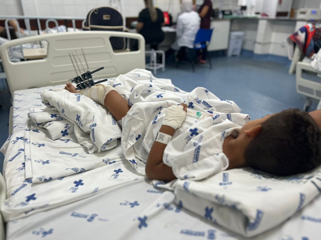 Hospital da Crianca registra aumento de 50 nas cirurgias ortopedicas durante ferias escolares