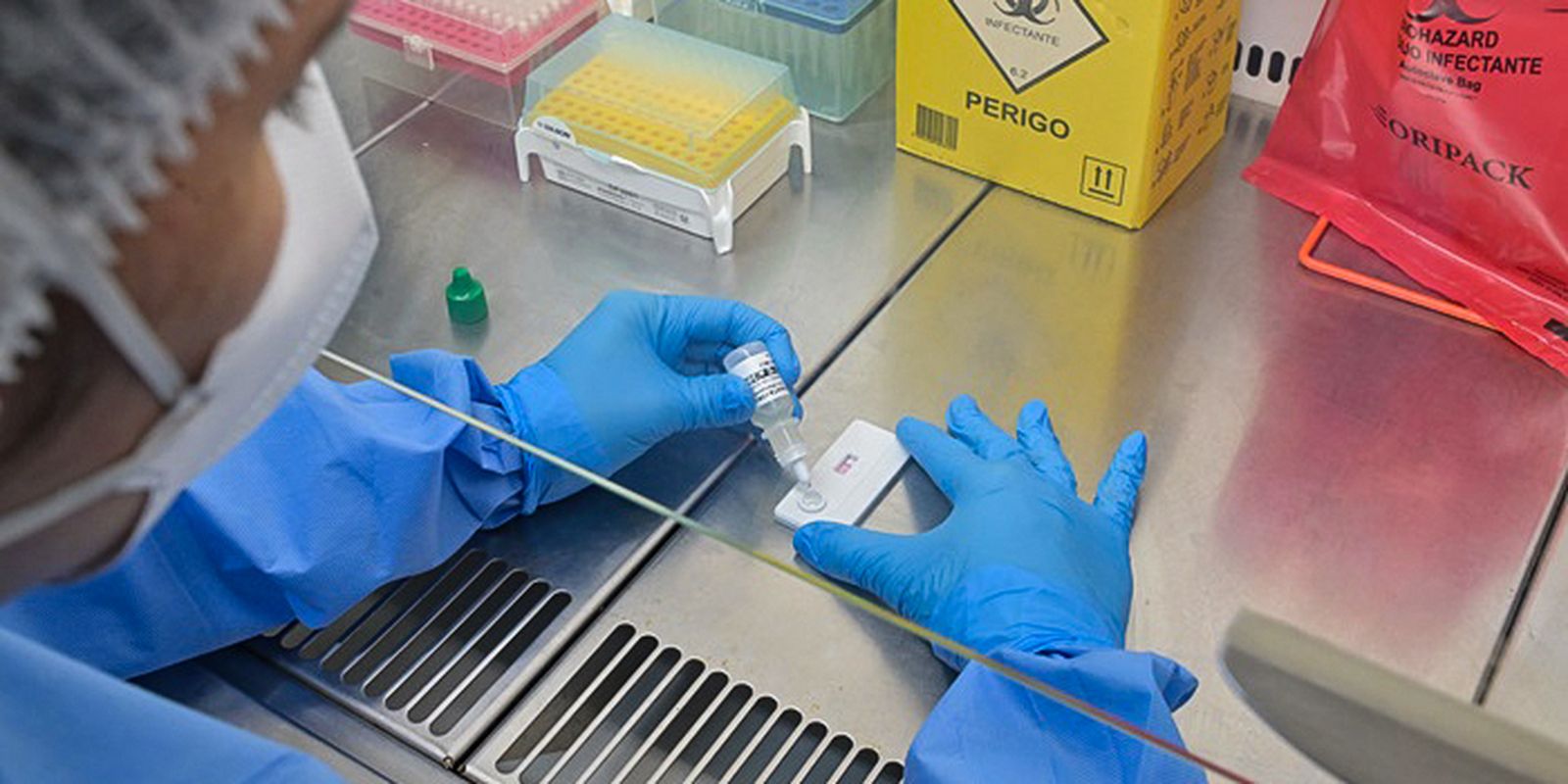 Anvisa redefine regras para laboratórios e aperta controle de qualidade 1 Anvisa redefine regras para laboratórios e aperta controle de qualidade