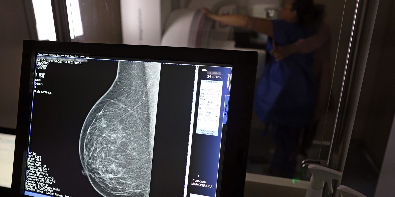 ANS exige cobertura de mamografia digital para todas as idades
