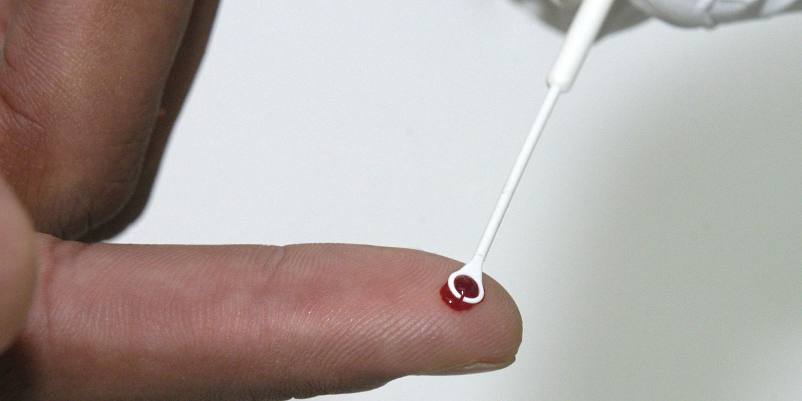 Fiji declara emergência por HIV após aumento recorde de casos